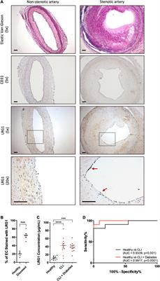 Leucine-Rich α-2-Glycoprotein 1 Suppresses Endothelial Cell Activation Through ADAM10-Mediated Shedding of TNF-α Receptor